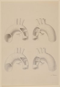 Menschlicher Aortenbogen (?) [aus einem Konvolut anatomischer Zeichnungen des Christian Koeck]